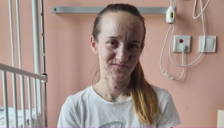 I verboi bomba ruse që i shpërtheu në banesë/ Historia tragjike e nënës ukrainase me dy binjakët e saj