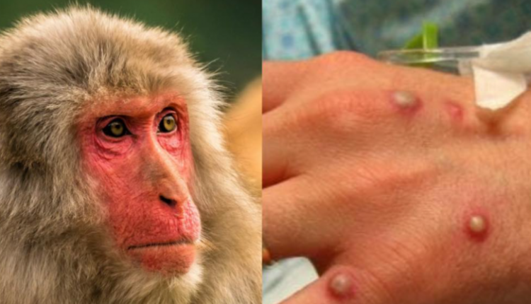 Dyfishohen të infektuarit me linë e majmunit në Serbi