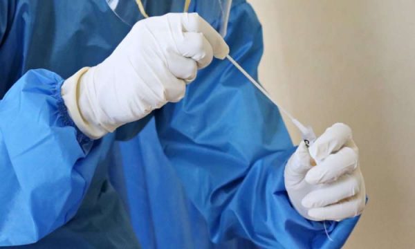 Regjistrohen dy viktima dhe 590 raste të reja me koronavirus