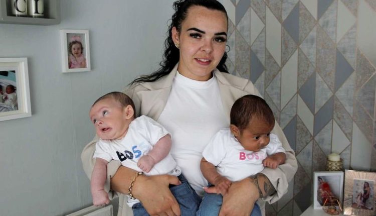 Gruaja lind binjakë me ngjyra të ndryshme të lëkurës