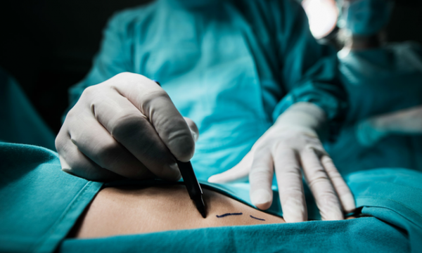 Paralajmërojnë kirurgët: Ky është vendi më i rrezikshëm për të kryer operacione plastike