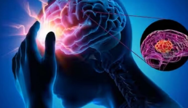 A mund të çojë migrena kronike në dëmtim afatgjatë të trurit?