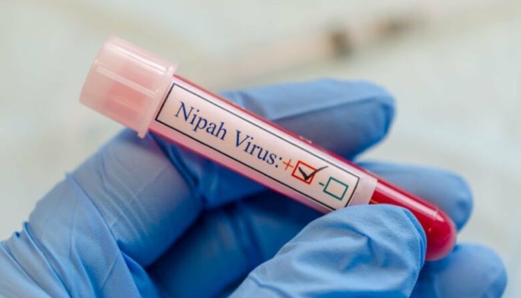 Virusi vdekjeprurës Nipah “mbërthen” Indinë, alarm në disa zona