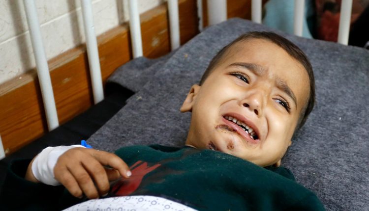Vogëlushi 3-vjeçar nga Gaza u mbijetoi tri sulmeve izraelite, por i amputohen të dy këmbët (VIDEO)